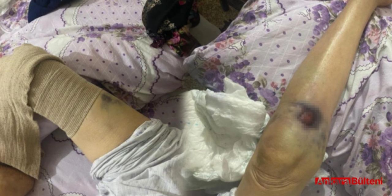 Bakıcısı tarafından darp edilen 91 yaşındaki kadın hayatını kaybetti!